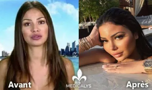 Maeva Ghennam : le scandale chirurgical 2024 et OnlyFans editorial
