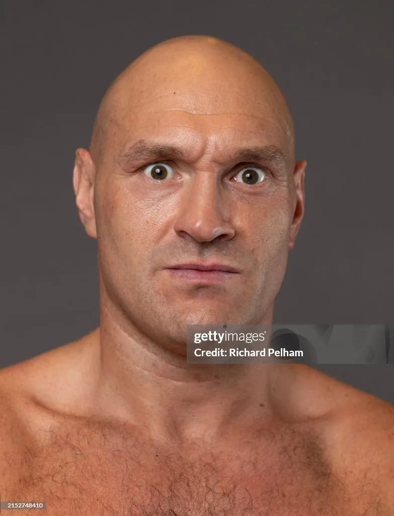Tyson Fury editorial